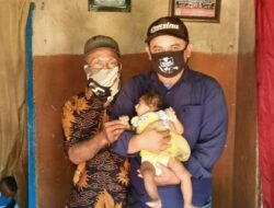 Relawan GIPS Kunjungi Nabila, Bayi Penderita Mikrosepalus Dan Kekurangan Gizi