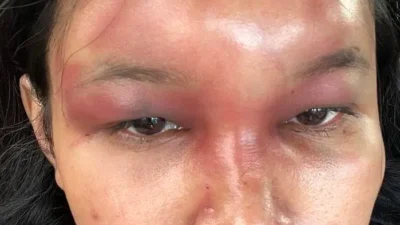 Wanita di Batam Dianiaya Mantan Pacar, Kasus Viral di Media Sosial