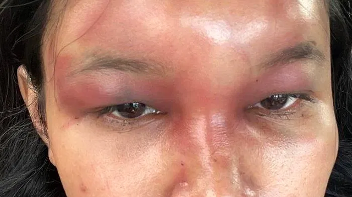 Wanita di Batam Dianiaya Mantan Pacar, Kasus Viral di Media Sosial