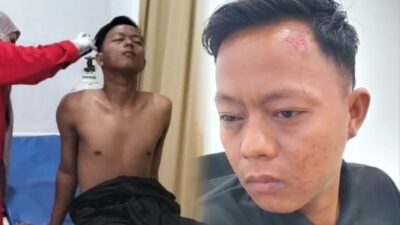 Brutal! Kawanan Security di Kawasan Industri Wiraraja Kabil Keroyok Sigit, Security PT Xin Poly