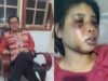 Penganiayaan ART Asal Sumba di Batam, Tokoh Masyarakat NTT Kutuk Keras Perbuatan Majikan