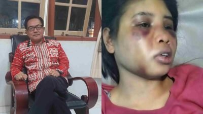 ART Asal Sumba Barat Disiksa Berat di Batam, Majikan dan ART Lain Ditahan